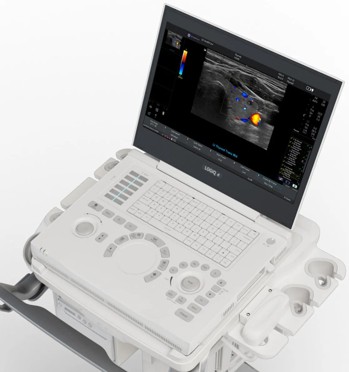 LOGIQ E Ultrasound