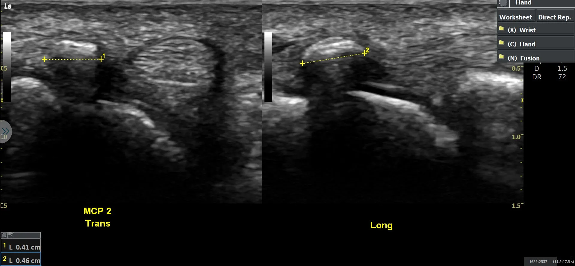 LOGIQ E Ultrasound