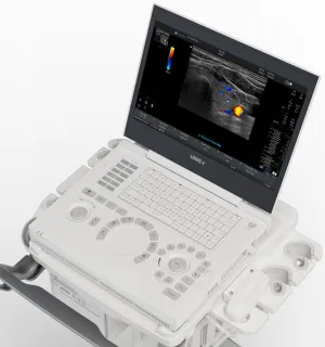 LOGIQ E Ultrasound